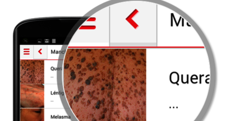 App para autoexplorarse la piel